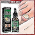 thumbnail image 2 of Jaysuing Ginger Nail Care Solution 30ml Nail Fungus Repair Hand, Foot Nail Care Soft Nail Bright, 2 of 5
