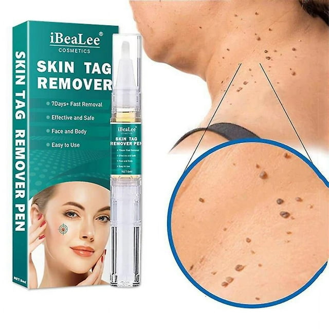 Crema De Tratamiento Para Eliminar Verrugas Y Lunares, 5 Ml, Para El Cuidado Facial, Bolígrafo Natural Para Eliminar Verrugas Y Lunares