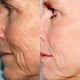 thumbnail image 5 of Inicio Kit de microdermoabrasión PMD Microderm Classic para rostro, 5 of 9