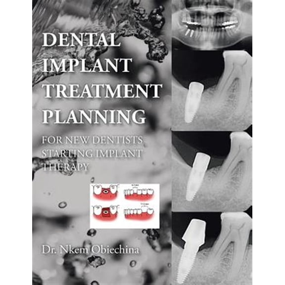 Pre-Owned Dental Implant Treatment Planning for New Dentists Starting Implant Therapy