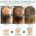 thumbnail image 3 of Exfoliante para el cabello con centella asiática, anticaspa, antipicazón, prevención y crecimiento del cuero cabelludo BF -4018496183592, 3 of 5