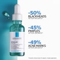thumbnail image 3 of Sérum La Roche-Posay Effaclar Tratamiento para Acné 30 ml, 3 of 9