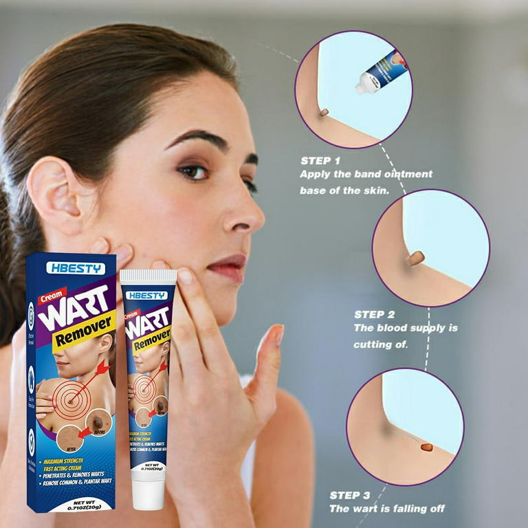 Best Wart Remover