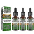thumbnail image 1 of 3x EELHOE Hair Oil For Dry Scalp Stimulates Hair Growth Hair Care Essential Oil Refreshing Firming Skin Rosemary Oil, 1 of 5