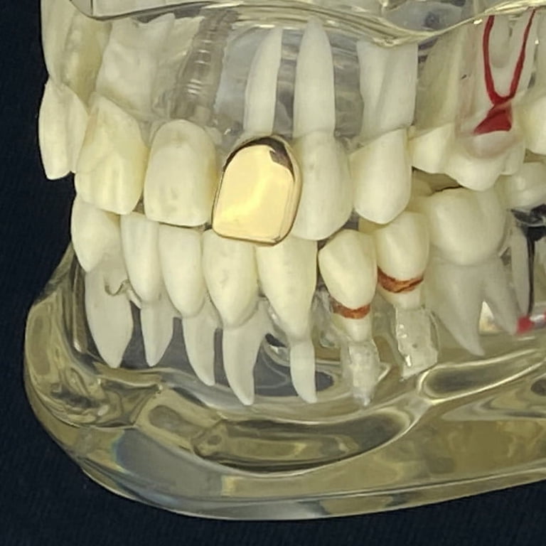 Single Gold Tooth