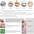 thumbnail image 2 of 2 herramientas de corrección de dedos encarnados, hebilla de corrección de dedos y levantador de dedos para uñas encarnadas y tratamiento de paronía (tamaño 37-40), 2 of 5