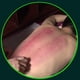 thumbnail image 5 of Latas de Vacío Masaje Ventosas de Silicona Absorbente de Humedad Ventouse Anti Celulitis Fisioterapia Dispositivo de Cuidado de 12 Piezas, 5 of 6