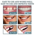 thumbnail image 2 of Denture Teeth Temporary Fake Teeth For Snap On Instant Confidence Smile, Dental Veneers For Temporary Teeth Restoration, 2 of 5