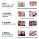 thumbnail image 5 of EELHOE toenail care patch, gray nail care patch, soft toenail, embedded nail, thickened bright nail groove care patch, 5 of 5