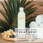 Flori Roberts Double O Complex Astringent - Facial Cleanser for Pimples - Helps Clear Acne Blemishes