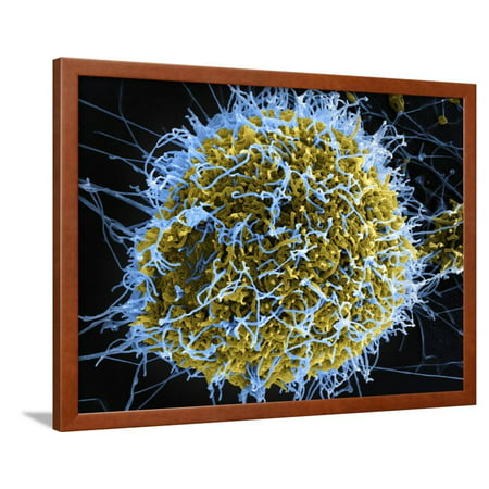 Colorized Scanning Electron Micrograph of Filamentous Ebola Virus Particles Framed Print Wall Art By Stocktrek