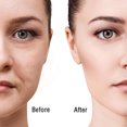 thumbnail image 4 of Ventosa facial juego de ventosas faciales respetuosas con el medio ambiente 4 piezas ligeras para salón de belleza ANGGREK Otros, 4 of 7