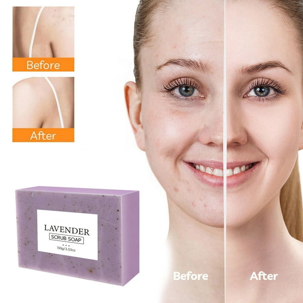 Salud y Belleza, Cuidado Personal, Jabón, Jabones, Jabón de Cúrcuma y Limón en Tabletas Jabón de Cúrcuma Limpiador Jabón de Ducha Facial y Corporal Reafirmante de Poros y Eliminador de Pigmentos 100g,