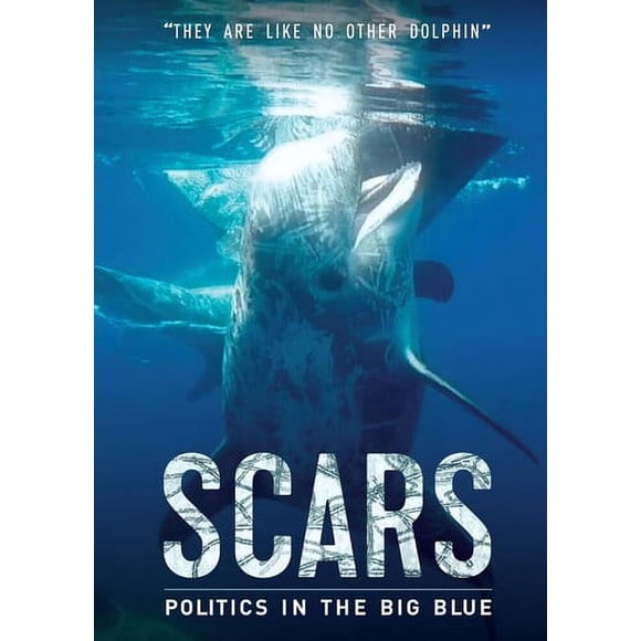 Scars