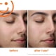 thumbnail image 5 of Limpiador facial Kate Somerville ExfoliKate de 50 ml con AHA, 5 of 8