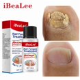 thumbnail image 1 of IBeaLee manufacturer wholesales antibacterial solution for onychomycosis, nail removal paste, thickening soft nail polish, and special solution for onychomycosis, 1 of 5