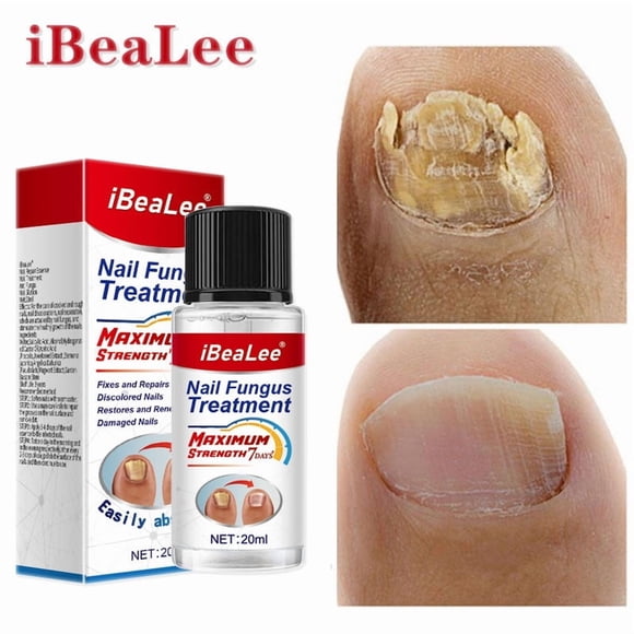 IBeaLee manufacturer wholesales antibacterial solution for onychomycosis, nail removal paste, thickening soft nail polish, and special solution for onychomycosis
