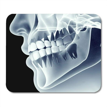 SIDONKU Xray X Ray of Jaw Teeth Mouth Human Radiography Dental Dentist Mousepad Mouse Pad Mouse Mat 9x10