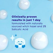 CLEAN & CLEAR ADVANTAGE Acne Spot Treatment Oil-Free 0.75 oz (Pack of 2)