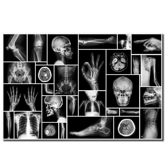 Art Mural Crâne Humain Noir et Blanc Peinture sur Toile Affiche Radiographique Impressions Image Murale pour Hôpital Orthopédique Chirurgien Bureau Décoration Murale Prêt à Accrocher sur 24x36 Pouces (24"x36 Pouces, Noir et Blanc)