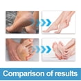 thumbnail image 3 of Banzch Foot Cream Foot Care Cream Percent For Feet Deeply Moisturize Skin Cream For Dry Cracked Feet Hands Heels Knees Exfoliates Dead Skin,Mothers Day Gifts, 3 of 6