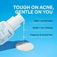 thumbnail image 2 of Serum innisfree, tratamiento suave con retinol salicílico para el acné, 50 ml, 2 of 9