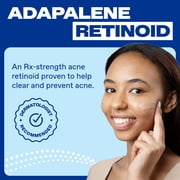 Differin Prescription-Strength Retinoid Acne Treatment Gel for Face with 0.1% Adapalene, Clears & Prevents Acne, Fragrance-Free, 15g Tube