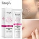 thumbnail image 1 of Gel LIMPIADOR EXFOLIANTE Facial, para el cuidado de la piel crema exfoliante, blanqueamiento, reparación hidratante, acné, espinillas, lavado de cara para limpieza de mujeres Fivean unisex, 1 of 1