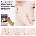 thumbnail image 5 of EELHOE 8Pcs Silicone Scar Sheets Safety Mild Odorless Comfortable Fade Scars Heal Treatment for Old -, 5 of 5