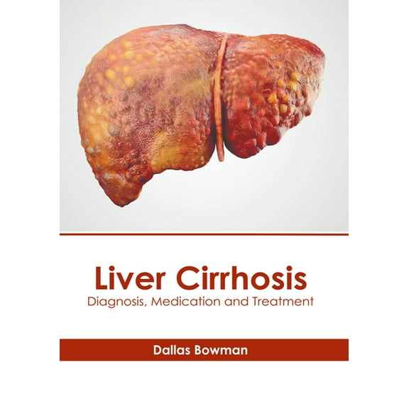 Liver Cirrhosis: Diagnosis, Medication and Treatment, (Hardcover)