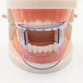 thumbnail image 3 of Mouth Opener Dental Orthodontic Braces Lip Cheek Retractor Expander Dental Mouth Oral Tooth Tool Care Orthodontic Accessory, 3 of 5