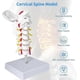 thumbnail image 3 of Model of cervical spine, lifesize with vertebrae, nerves and occipital plate, 3 of 5