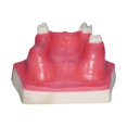 thumbnail image 1 of Milaget Dental Implant Model Display with Practice Soft Gums Dental Implant Training, 1 of 9
