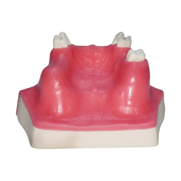 Modelo maxilar con Typodont Typodont Demostración Modelo de dientes Muestra de ayuda para la enseñanza de la capacitación en implantes dentales