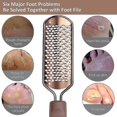 thumbnail image 3 of Pedicure Foot File Callus Remover -Large Foot Rasp Colossal Foot Scrubber Professional Stainless Steel Callus File for Wet and Dry Feet, 3 of 5