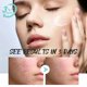 thumbnail image 3 of Crema reparadora de rojeces faciales, hidratante que mejora la sequedad de la piel sensible, loción hidratante de pata de gallo, eliminación de Rosacea, Cosméticos Coreanos, 3 of 5