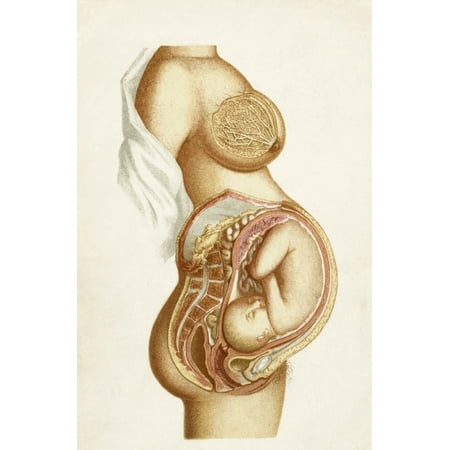 Semi-Diagrammatic Section Of A Full Time Pregnancy Showing Position Of Foetus In Utero From The Book Handbook Of Obstetric Nursing Published 1889 Canvas Art - Ken Welsh  Design Pics (22 x (Best Time And Position To Get Pregnant)