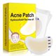 thumbnail image 2 of Parche para espinillas de acné, pegatinas hidrocoloides para eliminación de manchas de acné, parches impermeables para el cuidado de la piel Facial, 20 Uds., 2 of 8