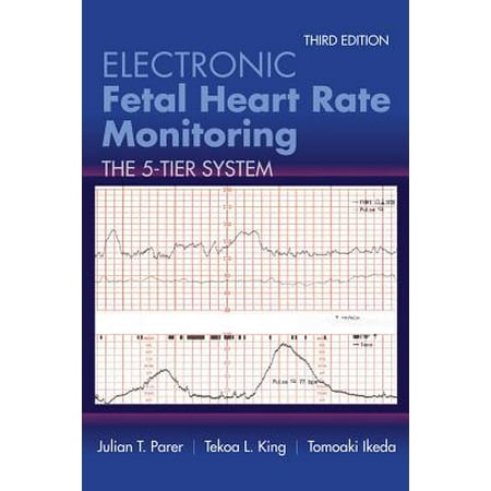 Electronic Fetal Heart Rate Monitoring : The 5-Tier