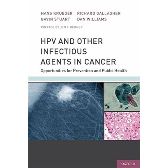 Pre-Owned Hpv and Other Infectious Agents in Cancer: Opportunities for Prevention and Public Health, (Hardcover)