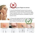 thumbnail image 5 of MRSXXNTY Professional Pimple Popper Tool Kit - 22 PCS Blackhead Remover Tools for Acne and Zit Popping Comedone Extractor with Magnifying Glass and Alcohol Pad, 5 of 5
