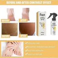 thumbnail image 5 of 2025 200ml Foot Exfoliation Spray Repair Dead Skin And Calluses Whitening Care Spray, 5 of 5
