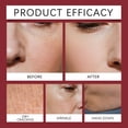 thumbnail image 3 of SDOHIG 2-Piece Castor Oil Roll-On Set, Deeply Nourishes Skin, Smoothes Rough Texture, Enhances Natural Brightness for Face and Body, 30ml, 3 of 8