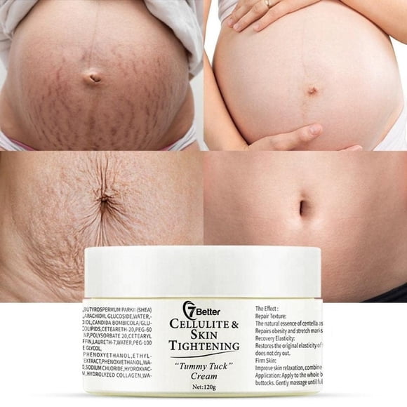 Crema para eliminar estrías y cicatrices durante el embarazo - Reparación de cicatrices Abdominal Reafirmante y suave Erradicación de estrías Cuidado de la piel Cuerpo