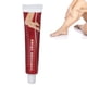 thumbnail image 1 of Loción Para Venas Varicosas, Extractos Naturales De Fácil Aplicación, Crema Para Venas Varicosas Que Promueven El Metabolismo Para El Cuidado Del Cuerpo, 1 of 7