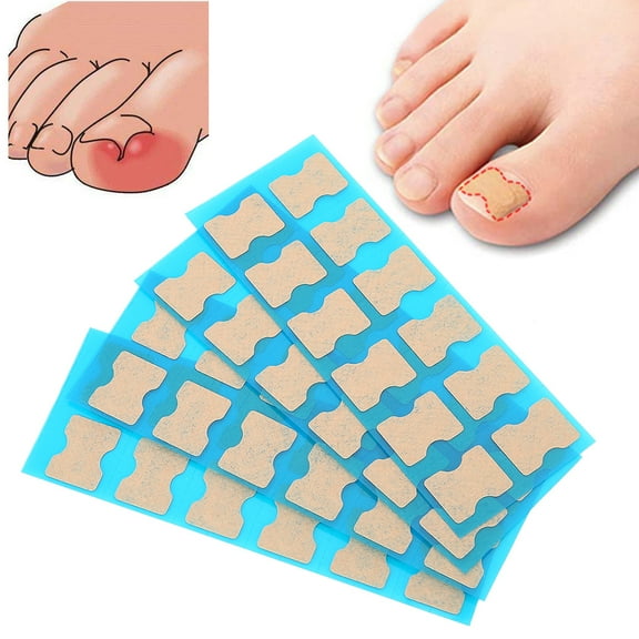 Tebru Foot Care Pedicure Sticker Ingrown Toenail Manicure Correction Patch Treatment
