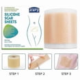 thumbnail image 5 of Self-Adhesive Silicone Scar Sheets - Medical Grade Scar Removal Patches for C-Section, Acne Scars, Keloid Surgery & Burn Scars, 5 of 5