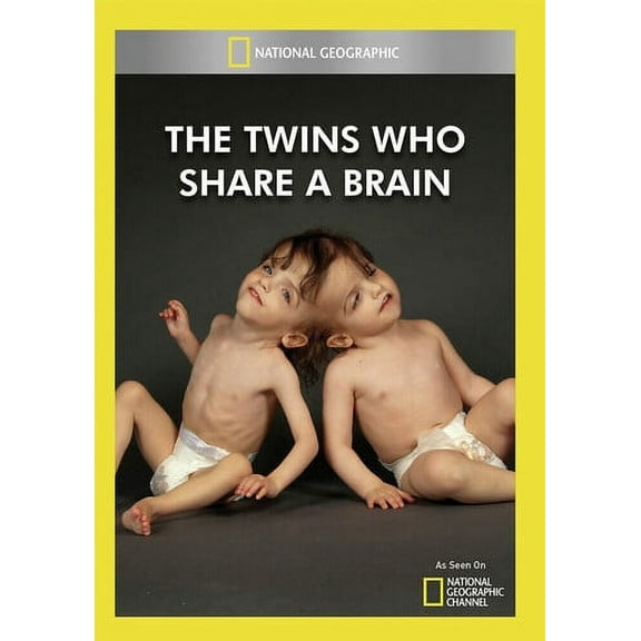 Twins Who Share a Brain (DVD), National Geographic, Documentary