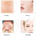 thumbnail image 1 of Mini Facial Steamer Portable Cute Mist Steam Sprayer Spa Skin Vaporizer, 1 of 9