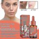 thumbnail image 3 of Jaysuing Rose Black Tea Squalane Essence Anti-dullness, Anti-wrinkle, Dryness, Hydration, Firming And Brightening Skin Anti-aging Skin C, 3 of 4
